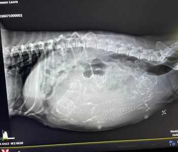 X-ray