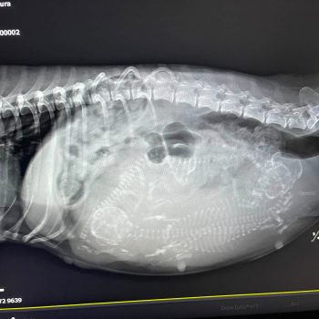 X-ray